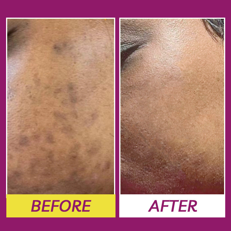 Fade spots face cream